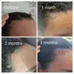 Hair Oil